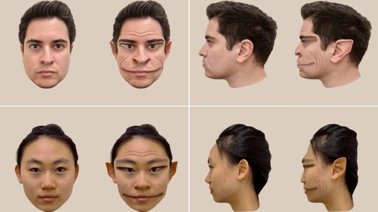 Rare Condition Makes Faces Demonic In Person