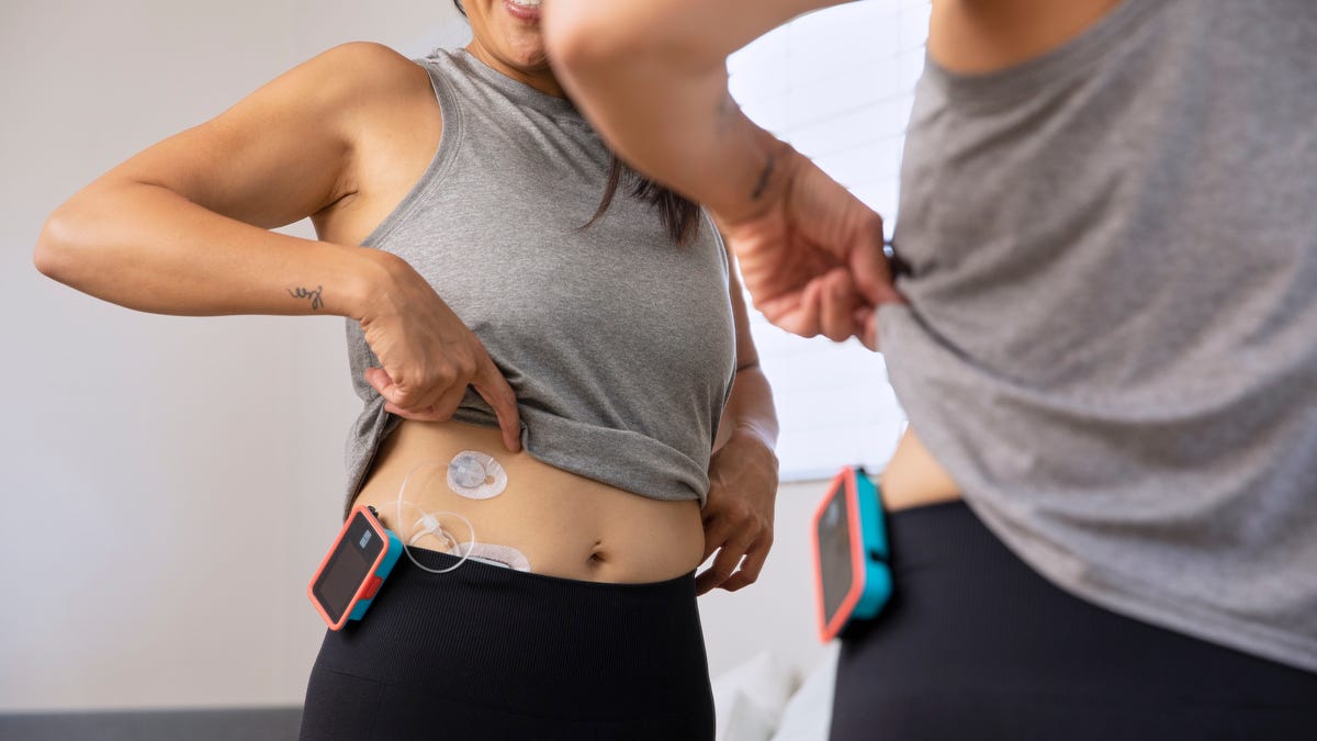 NHS to Provide Artificial Pancreas Systems to Type 1 Diabetes Patients